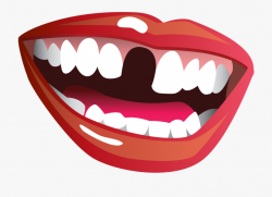 Dentist Missing Teeth Funny Clipart - Smile With Missing ...