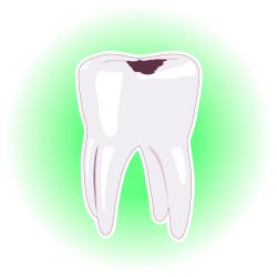 Reasons You Might Need A Dental Crown - Family Dentist in ...