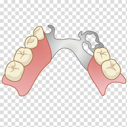Dentures Dentist Removable partial denture Dental technician ...
