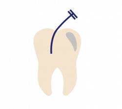 Endodontist in Jacksonville FL | Dr. Daniella S. Peinado | Root Canal