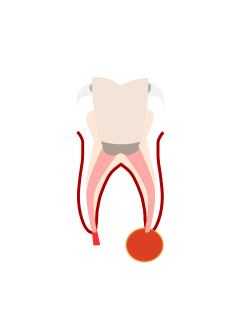 Teeth Whitening East Sheen | Whiter Teeth Richmond | Barnes