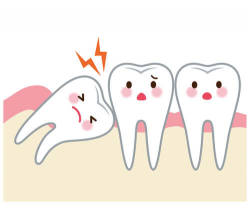 What You Need to Know About Extracting Your Wisdom Teeth ...