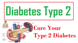 Free Type 2 Diabetes Cliparts, Download Free Clip Art, Free ...