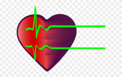 Rate Clipart Coronary Heart Disease - Png Download (#2624290 ...