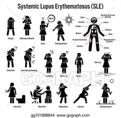 Vector Illustration - Systemic lupus erythematosus sle ...