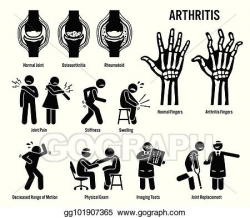 Vector Clipart - Arthritis, joint pain, and joint disease ...