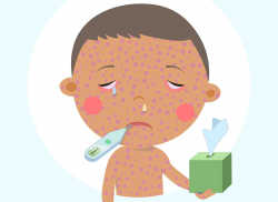 State Vulnerable to Measles Outbreak » Urban Milwaukee