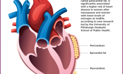 Certain heart fat associated with higher risk of heart ...