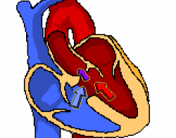 bradycardia – The Student Physiologist