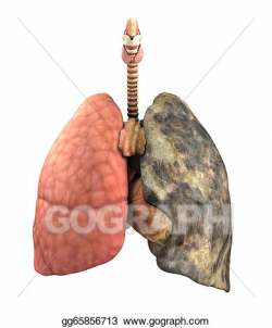 Drawing - Lung disease before and after. Clipart Drawing ...