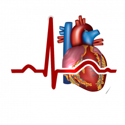 Myocardial infarction Heart Cardiovascular disease Symptom - heart ...