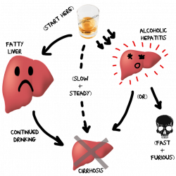 How exactly does alcohol cause liver problems? | retroflexions.com