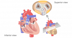 Heart Valves: Anatomy and Function
