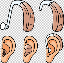 Hearing Aid Hearing Loss PNG, Clipart, Aids, Audiology ...