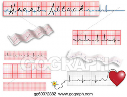 Vector Art - Full page ekg strips with heart att. Clipart ...