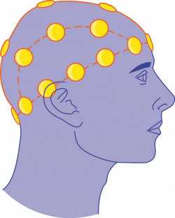 EEG - Electrods - Servier Medical Art - 3000 free medical images