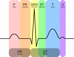 File:EKG Complex en.svg - Wikimedia Commons