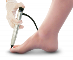 Clearanail® procedure is now available at United Foot & Ankle ...