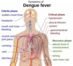 30 Terrible Diseases Caused by Water Pollution (HOW TO TELL)