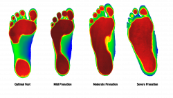 Foot Levelers Advantage – Middletown Health & Wellness Center