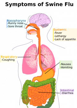 swine flu symptoms diagram - /medical/medical_problems/virus ...