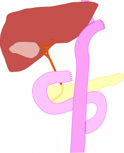 File:Total gastrectomy with Roux-en-Y.png - Wikimedia Commons