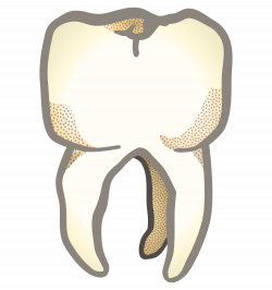 Clipart - tooth - coloured