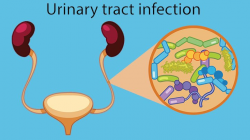 E. coli and Urinary Tract Infections (UTIs) | Everyday Health