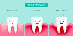 How Healthy Are Your Gums? • Synergy Dental Clinics