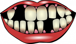 Healthy Teeth And Gums Clipart Understanding gum disease | body