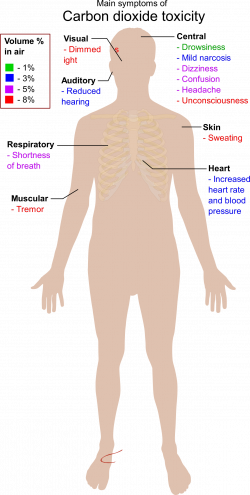 Clipart - Main Symptoms Of Carbon Dioxide Toxicity