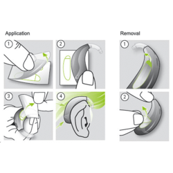 Phonak Stick 'n Stay hearing aid sticky pads | Connevans
