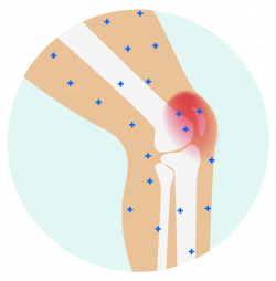 Learn Why Topical Joint Pain Relief is the Best Pain Killer ...