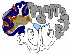 Traumatic Brain Injury – COSBID | Co-Operative Studies on Brain ...