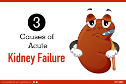 3 Causes of Acute Kidney Failure - By Dr. Sanjiv Saxena ...