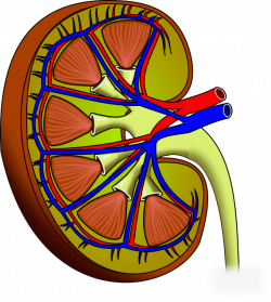 Kidney stone Chronic kidney disease Calculus - kidney 570*638 ...