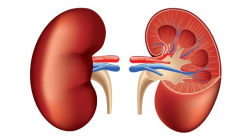 Renal Cell Cancer: Causes, Symptoms, and Diagnosis