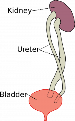 Duplicated ureter - Wikipedia