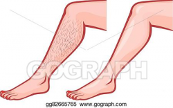 Vector Stock - Woman legs before and after depilat. Clipart ...