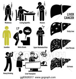 Vector Stock - Liver cancer symptoms. Clipart Illustration ...