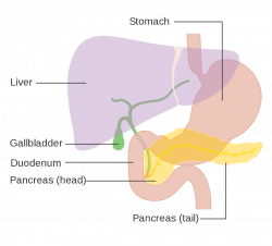 Pancreatic cancer - Wikipedia