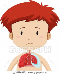 Vector Clipart - A kid with lung disease. Vector ...