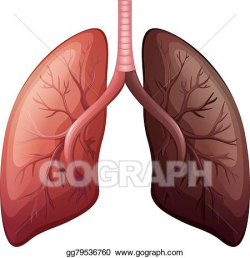 Vector Illustration - Lung cancer diagram in large scale ...