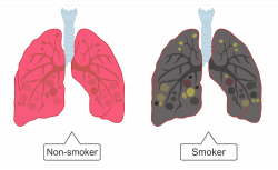 Smoking and Health Worksheet - EdPlace