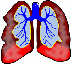 For Lung Transplant, Researchers Surprised to Learn Bigger Appears ...