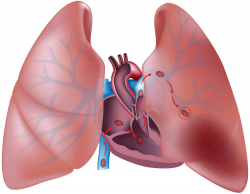 NuvaRing Pulmonary Embolism - Increased Risks, Causes & Symptoms