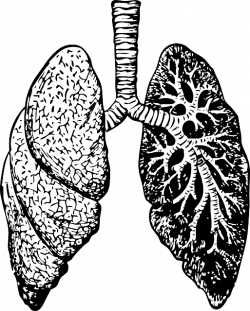 Lung Cancer Drawing at GetDrawings.com | Free for personal use Lung ...