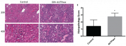 Epstein-Barr Virus (EBV) Encoded Dutpase Exacerbates The Immune ...
