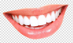 White teeth , Smile Tooth whitening Mouth, Teeth transparent ...