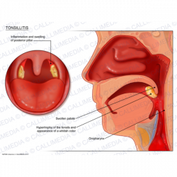 Colorful Tonsils Anatomy And Physiology Image - Anatomy And ...